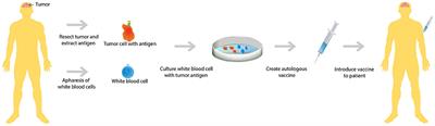 Immunotherapy and Epigenetic Pathway Modulation in Glioblastoma Multiforme